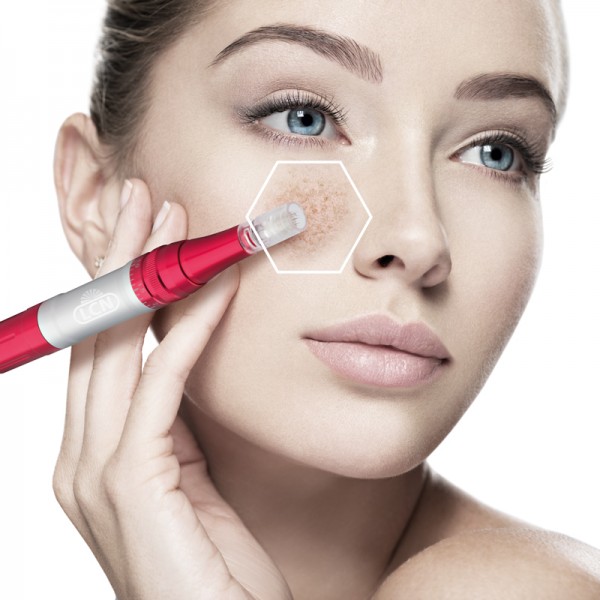 micro needling image